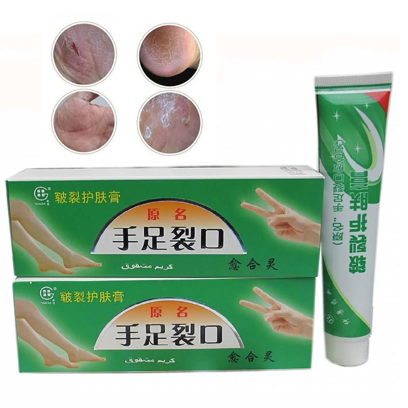 Plantar Crack Care Cream 100% Herbal Hand Foot Skin Splitting Cure Hydrating Ointment Chinese Medicine Cleft Treatment Plaster