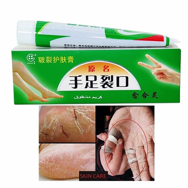 Plantar Crack Care Cream 100% Herbal Hand Foot Skin Splitting Cure Hydrating Ointment Chinese Medicine Cleft Treatment Plaster