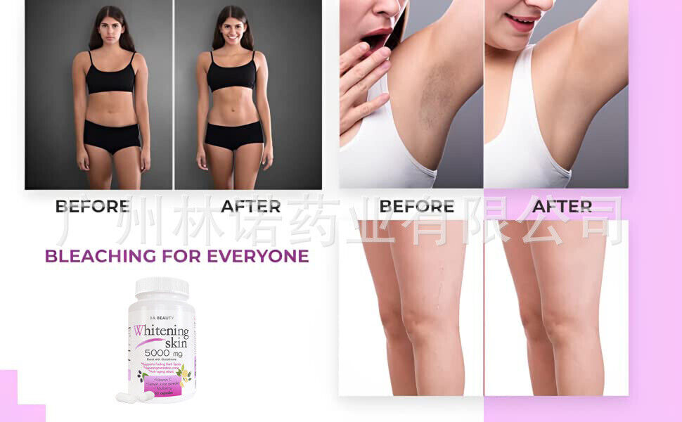 Whitening Skin 5000mg capsule|L-GLUTATHIONE PILLS-60/120caps