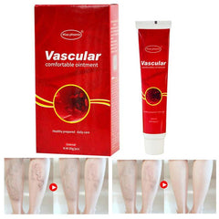 Varicose Veins Treatment Cream Ointment Vasculitis Phlebitis Spider Veins Pain Varicosity Angiitis Remedy Removal Herbal Cream