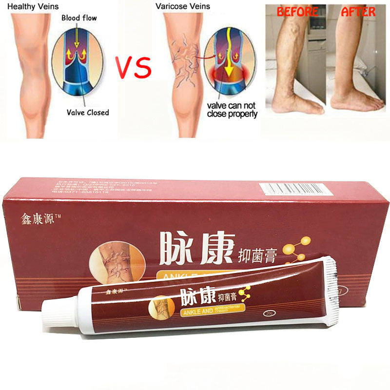 Chinese Natural Herbal Medicine for Varicose Veins Ointment Vasculitis Inflammation Leg Massage Varicose Veins Cream