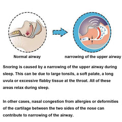 Health Care Silicone Anti Snoring Tongue Retaining Device Snore Solution Sleep Breathing Apnea Night Guard Aid Stop Snore Sleeve