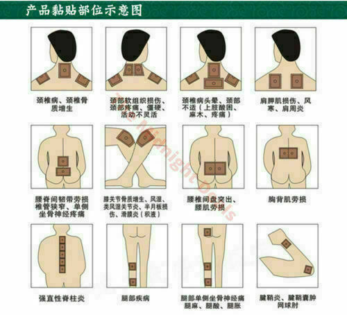 羚锐壮骨麝香止痛膏 10包（10片/包）LingRui Zhuang Gu She Xiang Zhi Tong Gao 10 Bags（10Pcs/Bag）